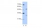 WBSCR1 antibody - middle region